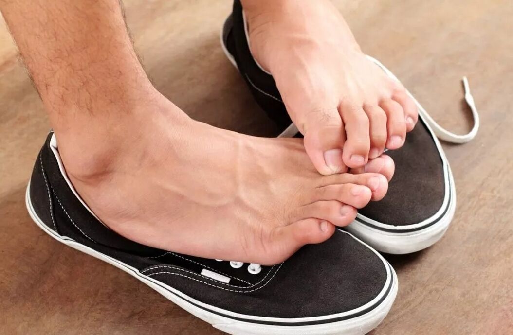 svědění na nohou v důsledku plísně mezi prsty